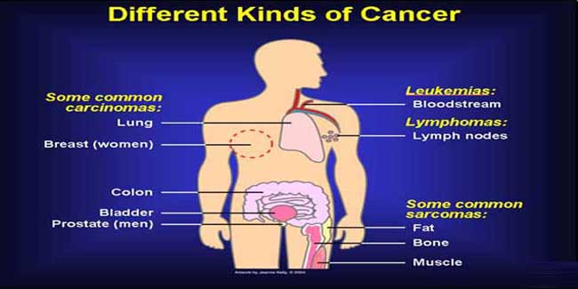 Symptoms Of Cancer That We Ignore