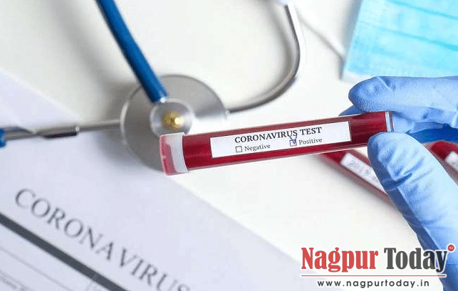 नागपुर में अब सिर्फ 426 कोरोना संक्रमित, संडे को नहीं हुई कोई मौत